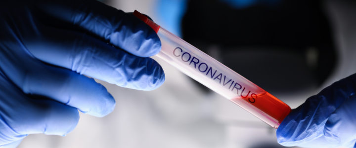 Umgang mit dem „Corona-Virus“ im ECHN